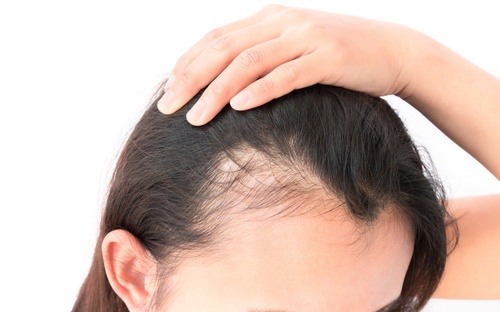 تجارب زراعة الشعر في تركيا , عمليات زراعة الشعر