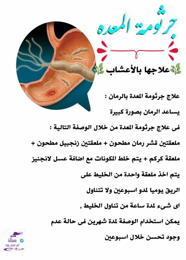 جرثومة المعدة اعراض - اسباب واعراض جرثومة المعدة 10205 15