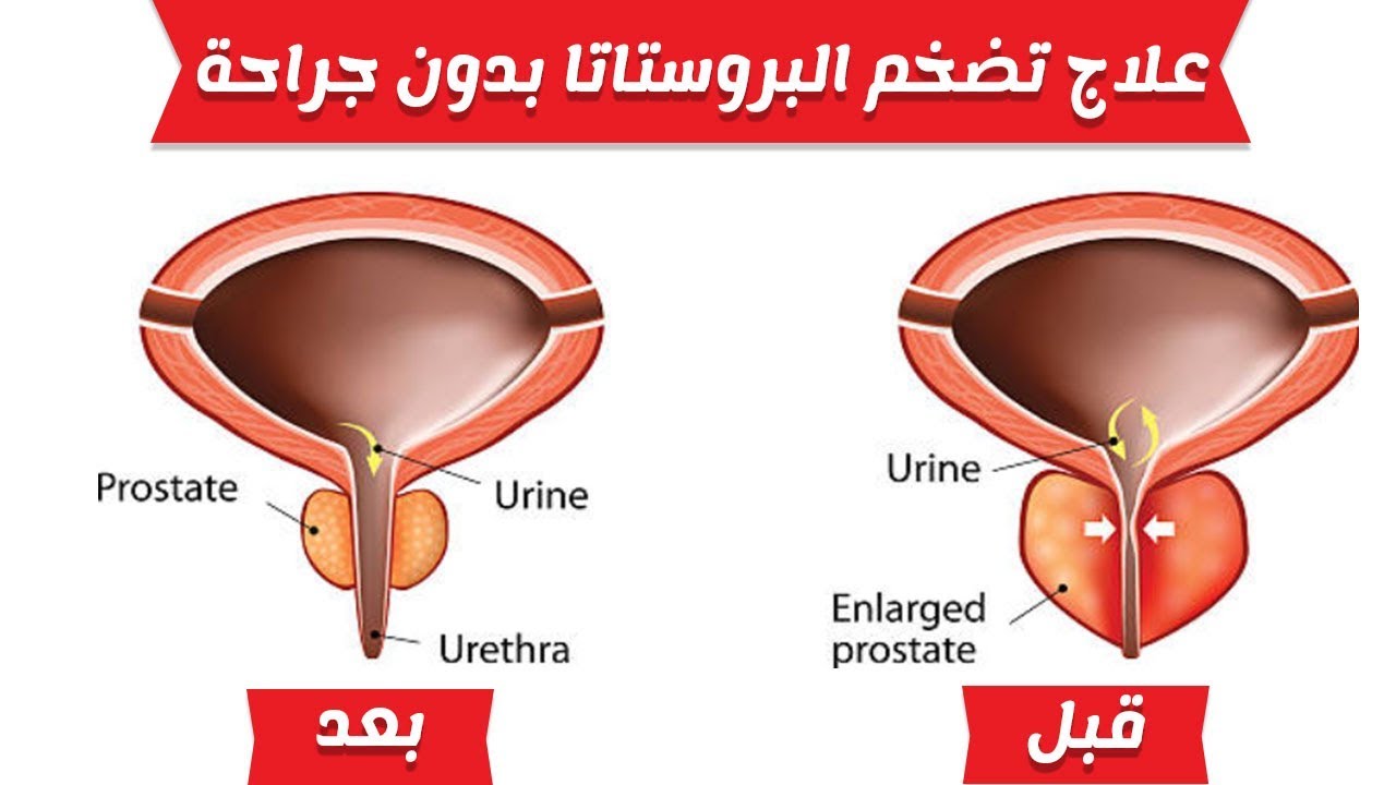 منطقة الجي سبوت عند الرجل بالصور - تعرف علي المنطقه واسباب ظهورها 10090 11