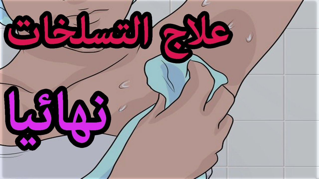 علاج تسلخات الجلد عند الكبار - تخلص من التسلخات بوصفة سحرية 10182 2