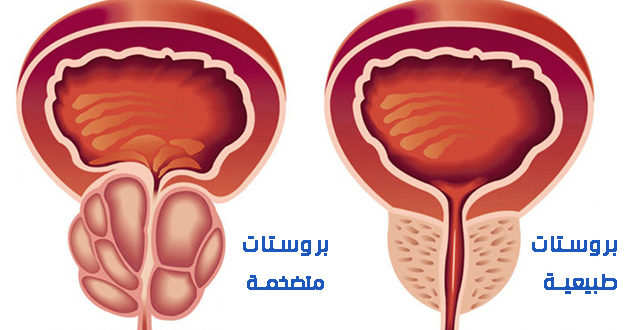 منطقة الجي سبوت عند الرجل بالصور - تعرف علي المنطقه واسباب ظهورها 10090 10