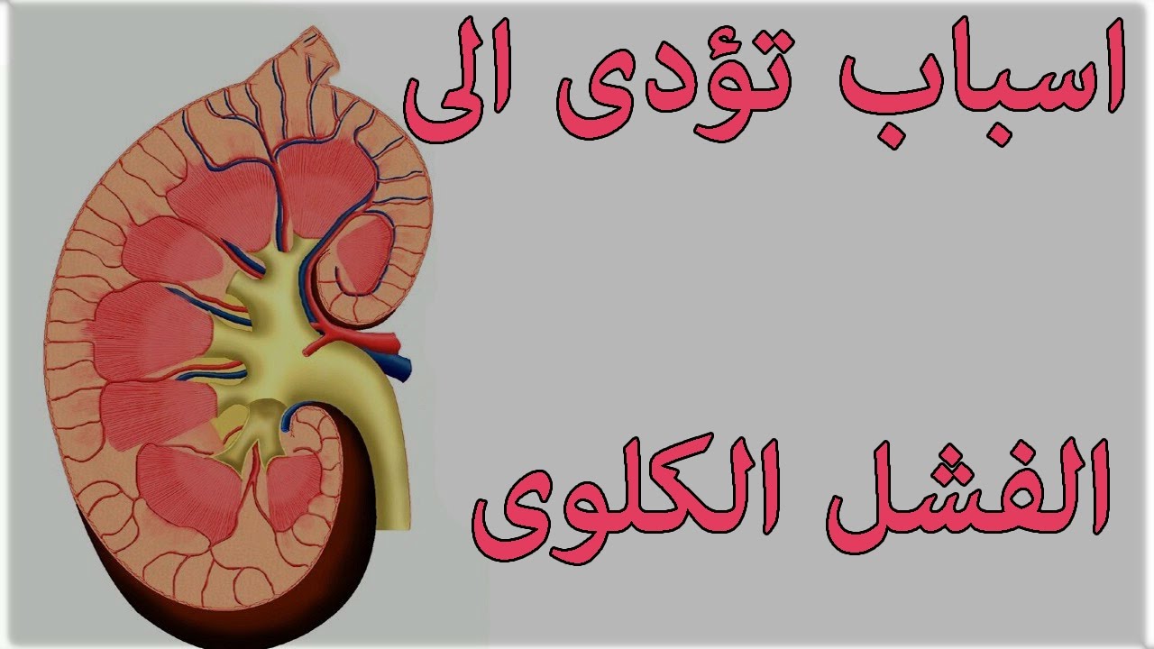 ماهي اسباب الفشل الكلوي , اعرف مرض العصر الفشل الكلوي