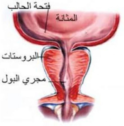 مرض البروستات - انواع الاصابه بالبروستاتا تفصيلا 4220 1