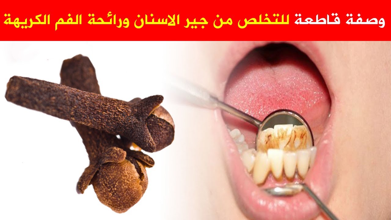 رائحة الفم الكريهة , مشكلة هامة قد تعرضك للاحراج