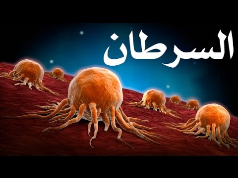 اخطر انواع السرطان - نصائح لتجنب خطر هذا المرض الخبيث 653 5