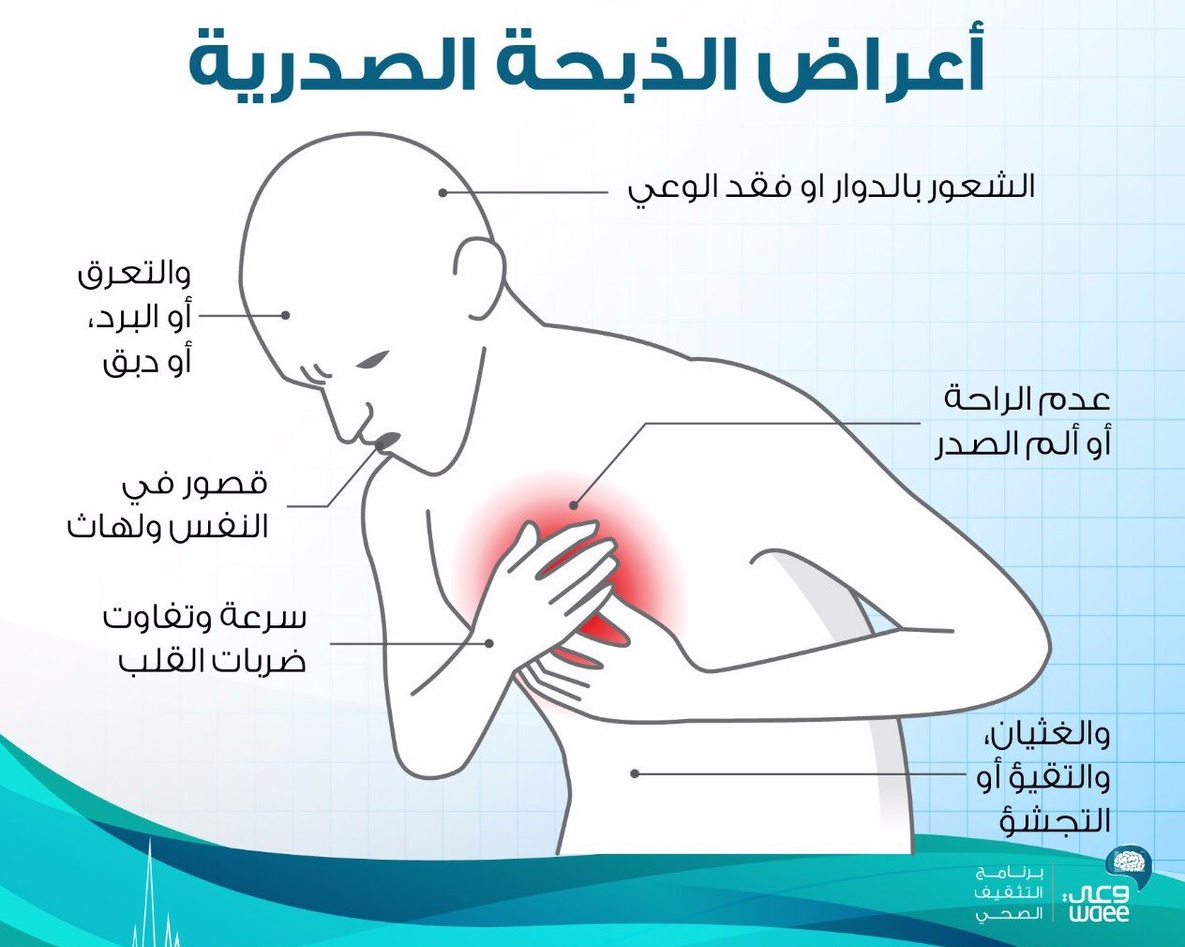 اعراض الذبحة الصدرية 4606