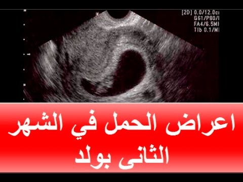 علامات الحمل بولد في الشهر الثاني , اعراض الحمل في الشهر الثاني