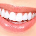 10085 12 طريقة تبيض الاسنان في المنزل - احصل على اسنان بيضاء بطرق سهلة وبسيطة من المنزل خاطرة نسيم